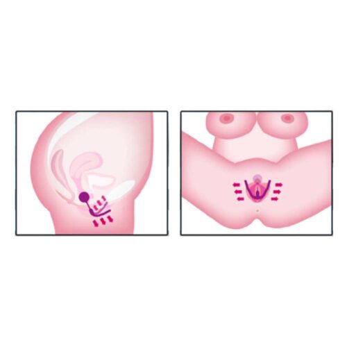 INTIMATE-SPREADER-PUSSY-GYM-171E810-9.jpg INTIMATE-SPREADER-PUSSY-GYM-171E810-9.jpg